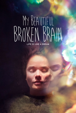 Watch Free My Beautiful Broken Brain Movies HD Online 123Movies